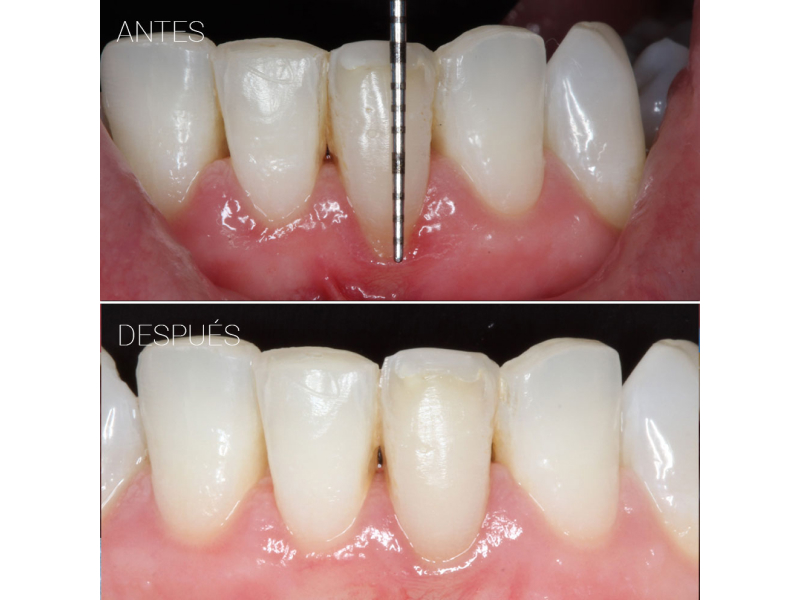 Periodoncia-2