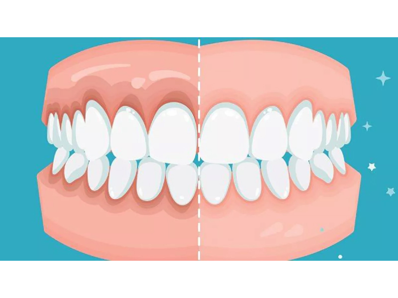 Periodoncia-3