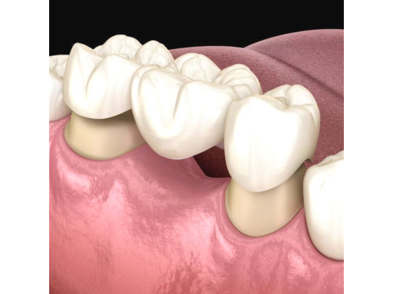 Rehabilitación oral-1